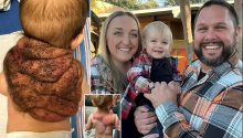 My ‘Ninja Turtle baby’ boy was born with a shell — he’s my superhero