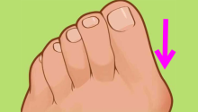 The painful bump on the side of your feet