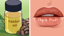 If you’re not using castor oil, you’re missing out. Here are 7 things you need to know