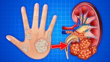 10 Warning Signs Your Kidneys May Be in Danger