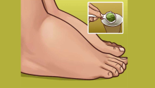 Eliminate Excess Water and Prevent Swelling in Your Hands and Feet with These Easy Recipes