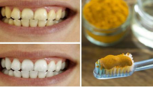 Discover How Turmeric Can Transform Your Life and Enhance Your Dental Health Naturally