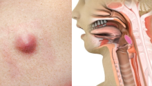 You Should Pay Attention to These 15 Early Warning Signs of Cancer in Your Body